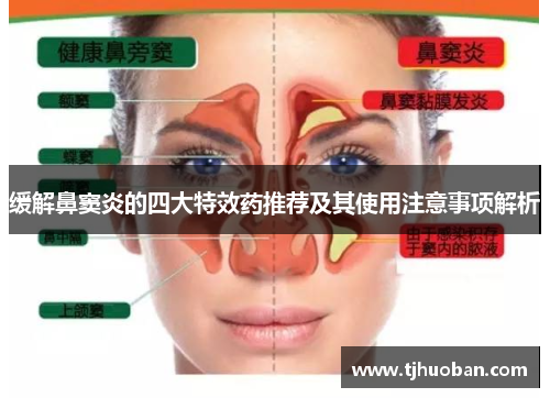 缓解鼻窦炎的四大特效药推荐及其使用注意事项解析